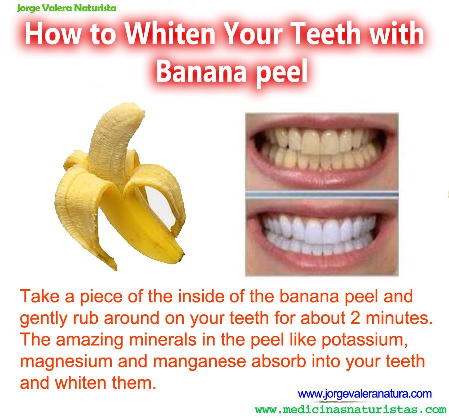 how to whiten teeth naturally fast